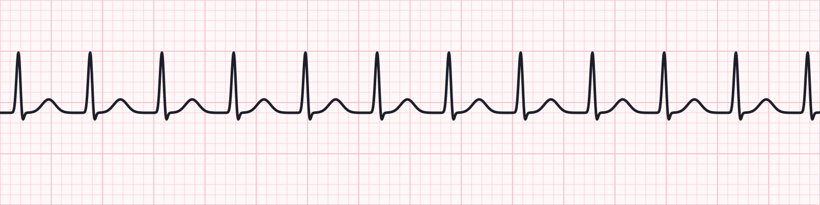 Taquicardias_UAA_Diapositiva_07_1.png