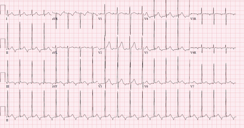 Taquicardias_UAA_Diapositiva_09_1.png