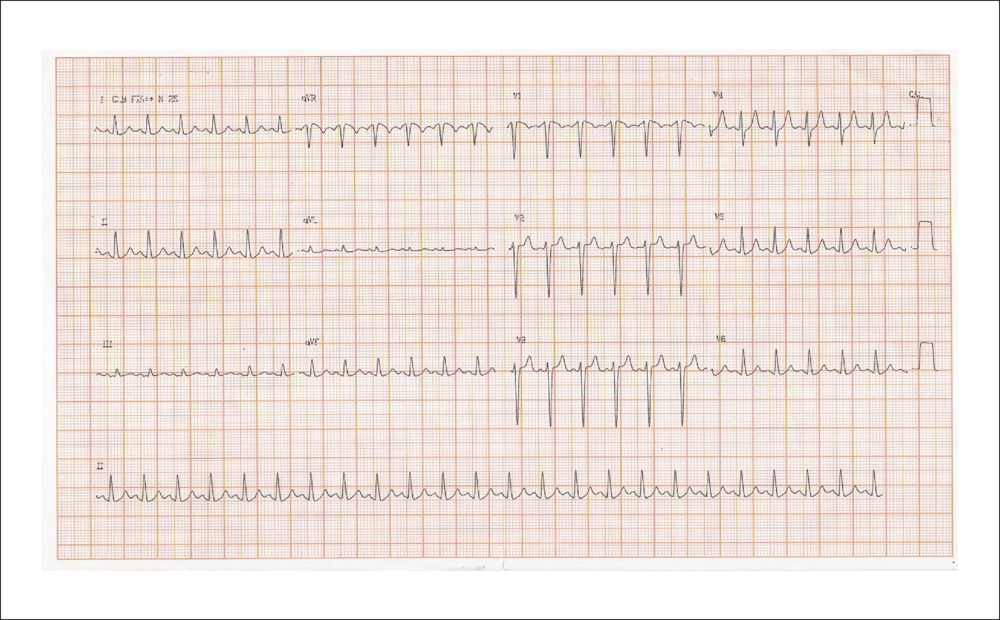 Taquicardias_UAA_Diapositiva_11_1.png