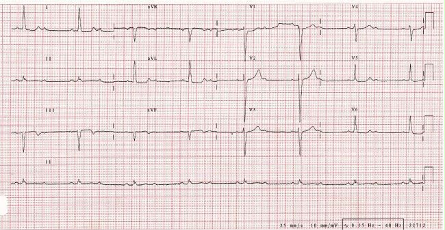 attachments/ECG_practica_07_BFA.jpeg