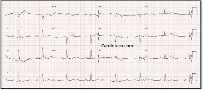 attachments/ECG_practica_09_BFP.jpeg