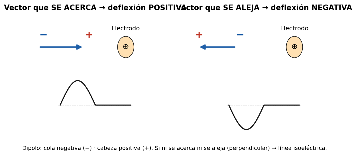 attachments/Slide_EKG_generalidades_11-13_dipolo_vector.png