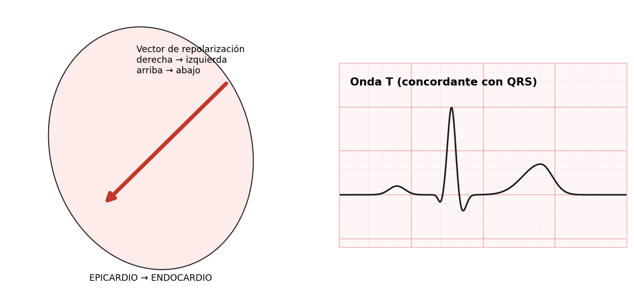 attachments/Slide_METODO_33_vector_repolarizacion.png