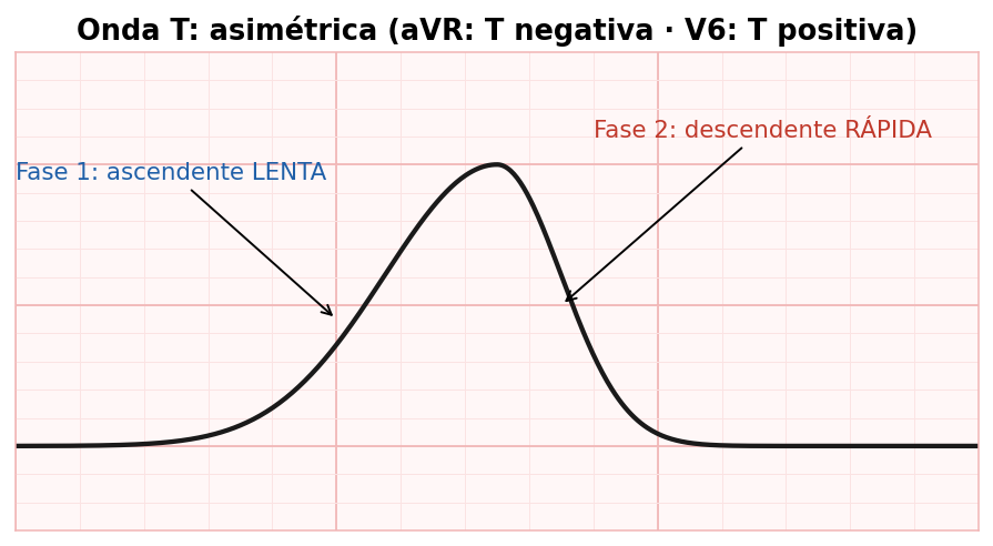 attachments/Slide_METODO_39_onda_T.png