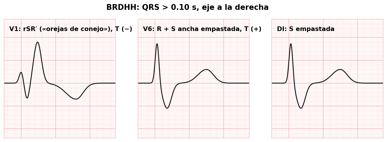attachments/Slide_bloqueos_03-05_BRDHH.png