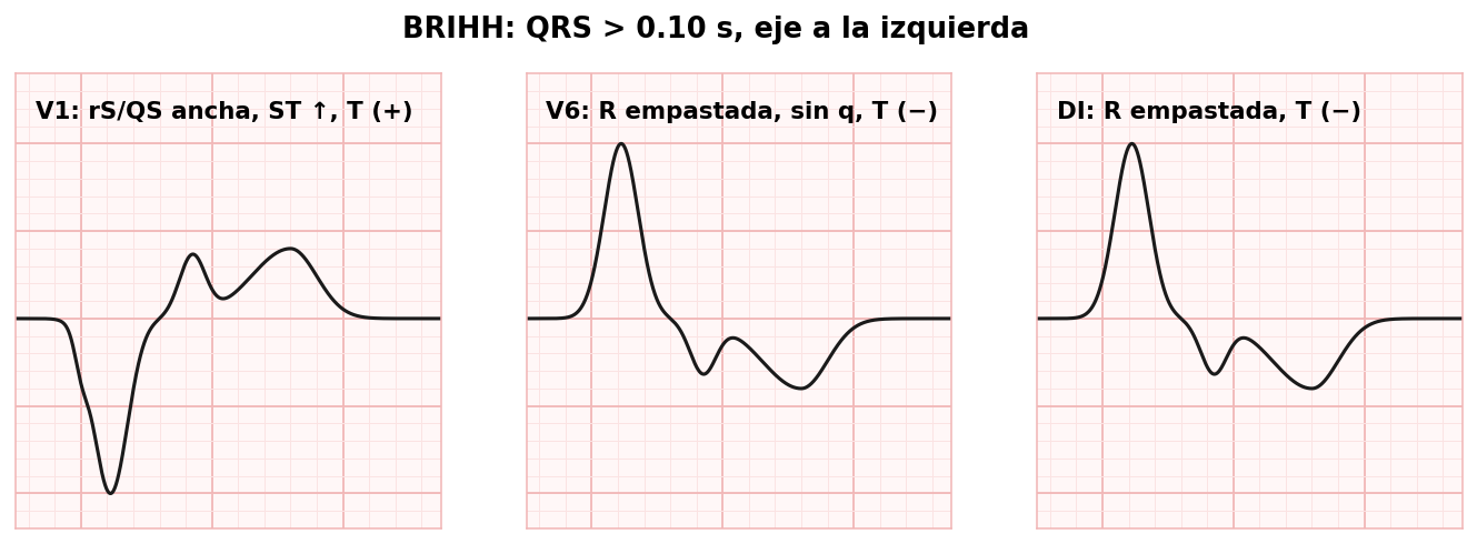 attachments/Slide_bloqueos_06-07_BRIHH.png