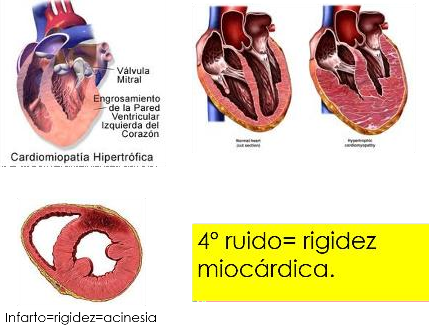 Cardio_image106.png186