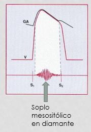 Cardio_image110.jpeg166