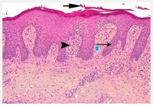 Adjuntos/U02_p06_fig01.png