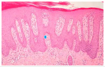 Adjuntos/U02_p06_fig02.png