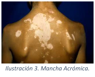 Adjuntos/U02_p11_fig04.png