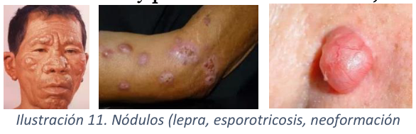 Adjuntos/U02_p12_fig06.png