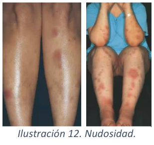 Adjuntos/U02_p13_fig01.png