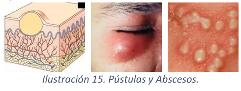 Adjuntos/U02_p14_fig01.png