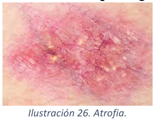 Adjuntos/U02_p15_fig06.png