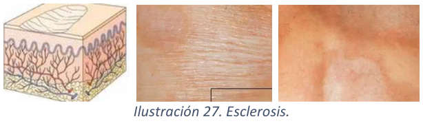 Adjuntos/U02_p16_fig01.png