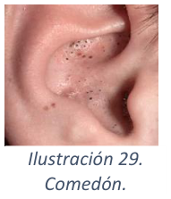 Adjuntos/U02_p16_fig04.png