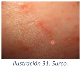 Adjuntos/U02_p16_fig06.png