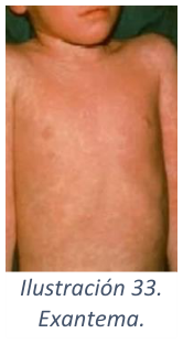 Adjuntos/U02_p17_fig01.png