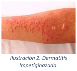 Adjuntos/U03_p20_fig02.png