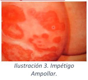 Adjuntos/U03_p20_fig03.png