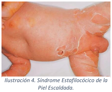Adjuntos/U03_p21_fig01.png