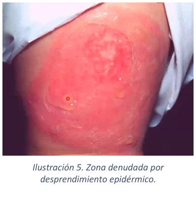 Adjuntos/U03_p21_fig02.png