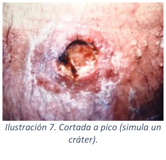 Adjuntos/U03_p22_fig02.png
