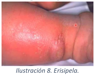 Adjuntos/U03_p22_fig03.png