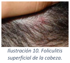 Adjuntos/U03_p23_fig02.png