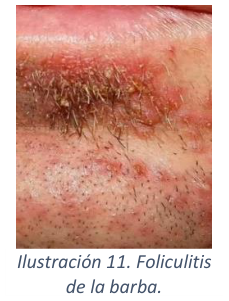 Adjuntos/U03_p24_fig01.png