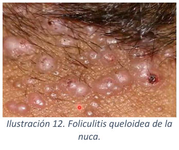 Adjuntos/U03_p24_fig02.png
