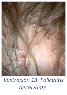 Adjuntos/U03_p24_fig03.png
