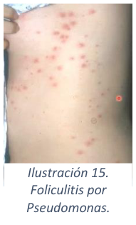 Adjuntos/U03_p24_fig05.png