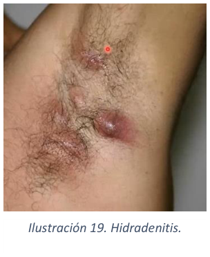 Adjuntos/U03_p26_fig01.png