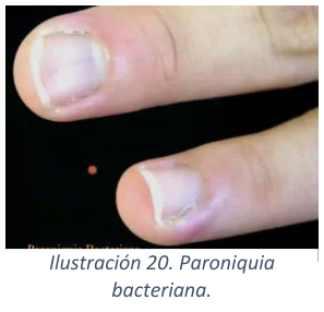 Adjuntos/U03_p26_fig02.png