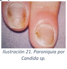 Adjuntos/U03_p26_fig03.png