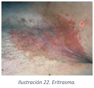 Adjuntos/U03_p27_fig01.png