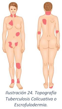 Adjuntos/U03_p31_fig01.png