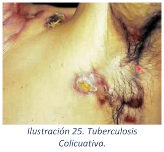 Adjuntos/U03_p31_fig02.png
