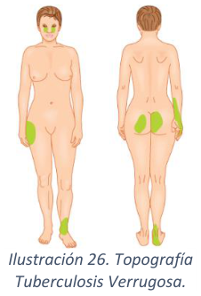 Adjuntos/U03_p32_fig01.png