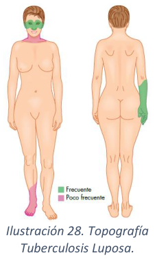 Adjuntos/U03_p32_fig03.png