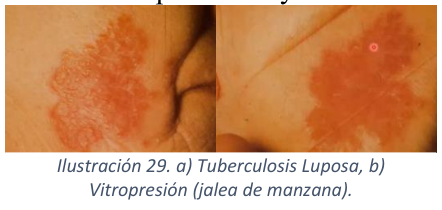 Adjuntos/U03_p32_fig04.png