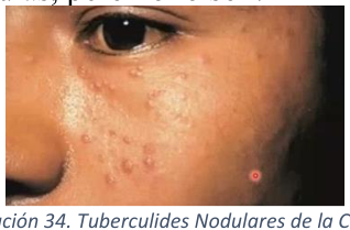 Adjuntos/U03_p33_fig05.png