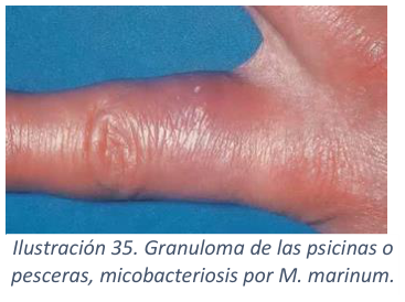 Adjuntos/U03_p34_fig02.png