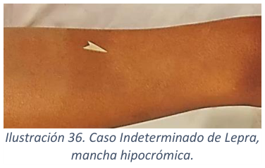 Adjuntos/U03_p36_fig02.png