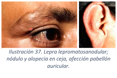 Adjuntos/U03_p36_fig03.png