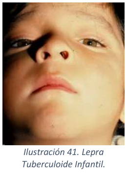Adjuntos/U03_p37_fig04.png