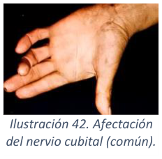 Adjuntos/U03_p37_fig05.png