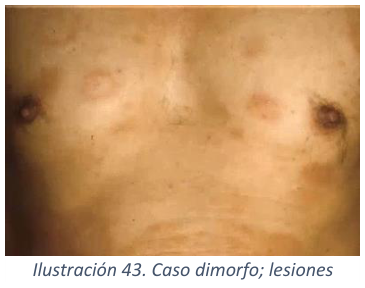 Adjuntos/U03_p38_fig01.png